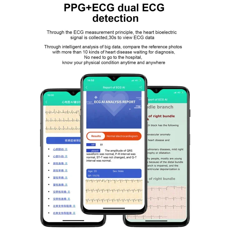 E86 1.7인치 TFT 컬러 스크린 IP68 방수 스마트워치, 혈중 산소 모니터링 / 체온 모니터링 / AI 의료 진단 지원, 스타일: TPU 스트랩, TPU 스트랩(블루), TPU 스트랩(블랙), TPU 스트랩(레드)