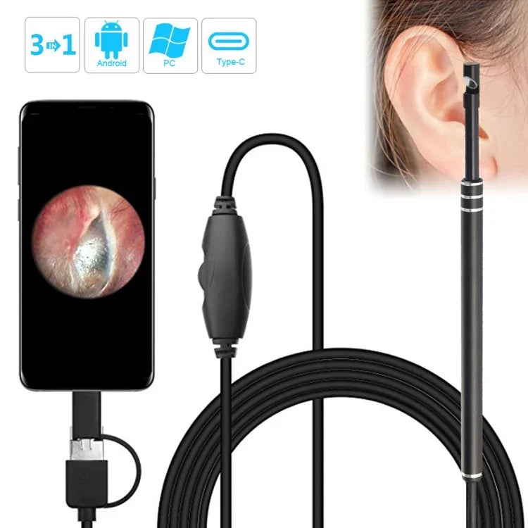 i96 3 in 1 USB 귀 내시경 검사 HD 0.3MP 카메라 시각 귀 스푼 OTG 안드로이드 폰 & PC & 맥북용, 1.85m 길이 케이블, 3 in 1 블랙 0.3MP