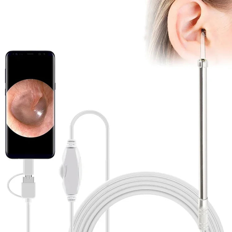 i95 3 in 1 USB 귀 내시경 검사 HD 0.3MP 카메라 시각 귀 스푼 OTG 안드로이드 폰 & PC & 맥북용, 1.75m 길이 케이블, 3 in 1 화이트 0.3MP
