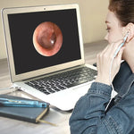 i95 3 in 1 USB 귀 내시경 검사 HD 0.3MP 카메라 시각 귀 스푼 OTG 안드로이드 폰 & PC & 맥북용, 1.75m 길이 케이블, 3 in 1 화이트 0.3MP