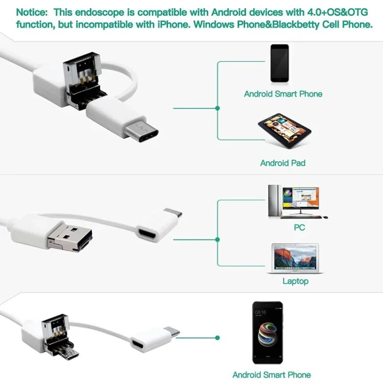 i95 3 in 1 USB 귀 내시경 검사 HD 0.3MP 카메라 시각 귀 스푼 OTG 안드로이드 폰 & PC & 맥북용, 1.75m 길이 케이블, 3 in 1 화이트 0.3MP