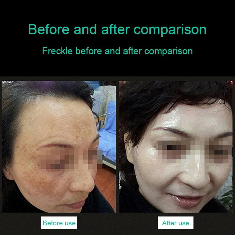 이미지 대체 텍스트