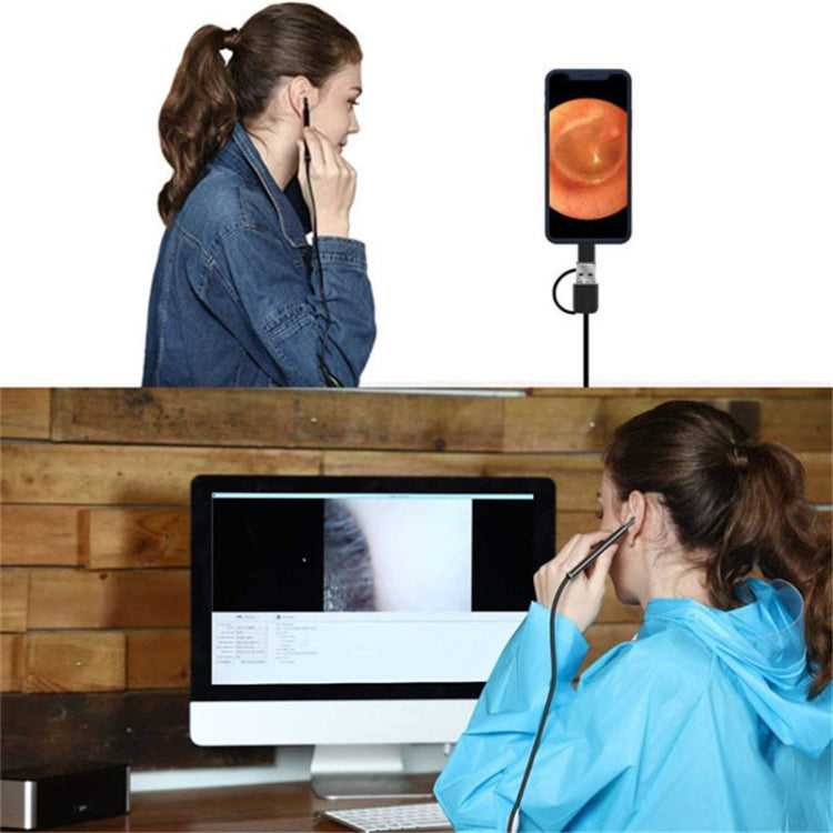3 in 1 USB HD 디지털 검사용 이경 디지털 내시경 귀지 제거기
