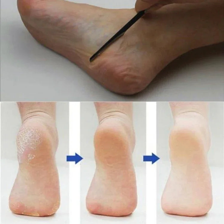 이미지 대체 텍스트