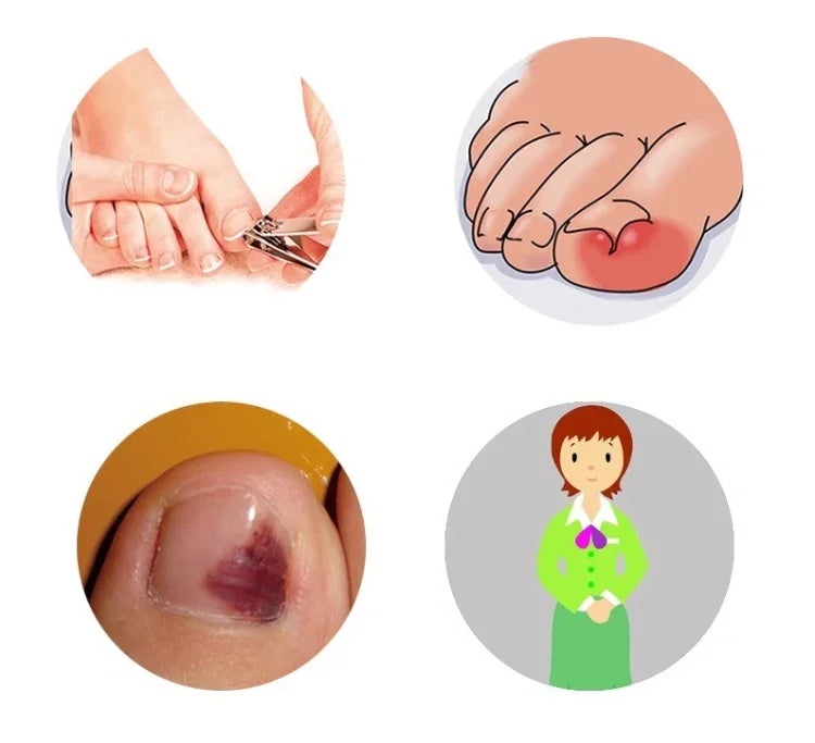 이미지 대체 텍스트