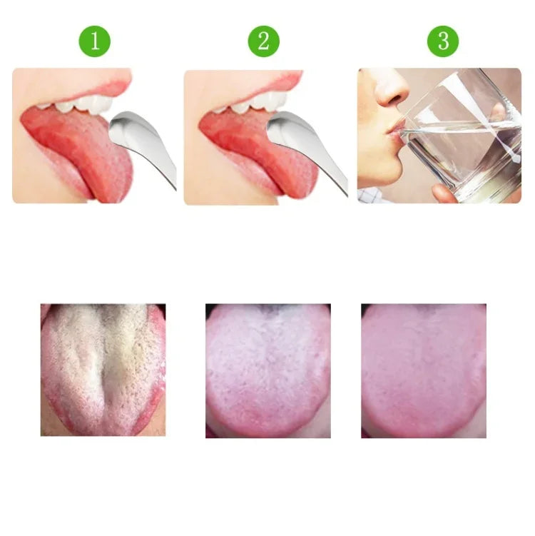 혀 클리너 구취 제거 스테인리스 청소 브러시 혀 스크레이퍼 + 2개 세트 (로즈 골드), 혀 스크레이퍼 + 2개 세트 (실버), 혀 스크레이퍼 + 2개 세트 (로즈 골드)