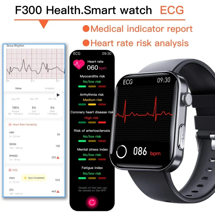 F300 2.1인치 화면 스마트워치 블루투스 통화/ECG/혈액 구성 분석/50+ 스포츠 모드 지원, 블랙 실리콘, 블랙 핑크 실리콘, 블랙 그레이 실리콘, 블랙 밀란, 블랙 3구 스틸, 블랙 가죽, 블랙 브라운 가죽